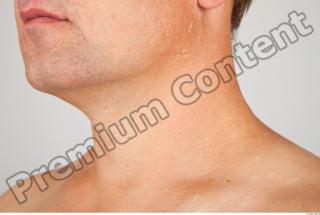 Neck 3D scan texture 0009